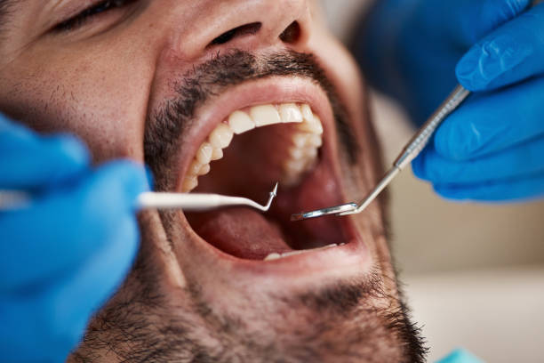 Tooth Infection Emergency Dentist in AL